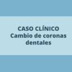 Caso clínico: cambio de coronas dentales de recubrimiento total