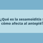 ¿Qué es la sesamoiditis y cómo afecta al antepié?