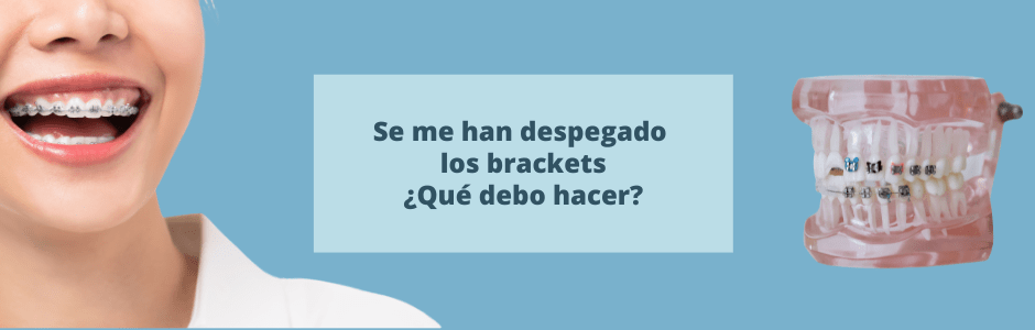 brackets