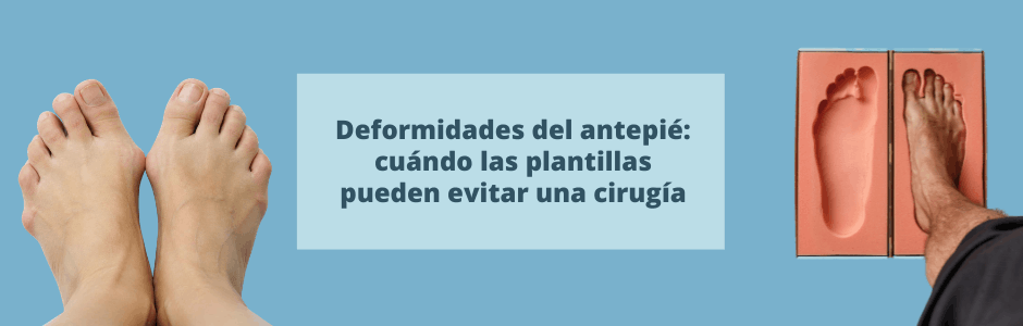Deformidades del antepié: cuándo las plantillas pueden evitar una cirugía